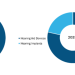 US Hearing Aids Market